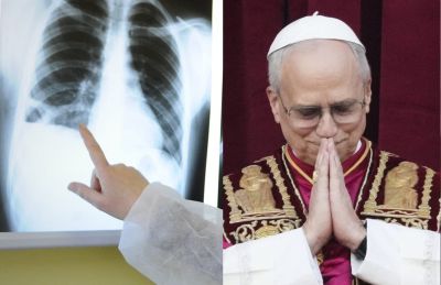 Rakovina, ktorú diagnostikovali aj pápežovi Levovi XIV., na Slovensku zabíja tisíce ľudí. Skrýva sa za banálne príznaky