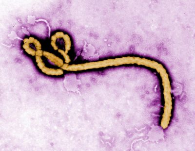 Podozrenie na ebolu u ženy v Rakúsku nepotvrdil ani druhý test
